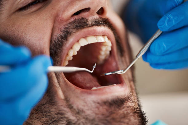 Best Chipped Tooth Repair Near Me  in Maytown, PA